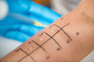 When Should I Consider Getting an Allergy Test?