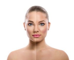 Read more about the article Peel Away Sun Damage with a VI Peel