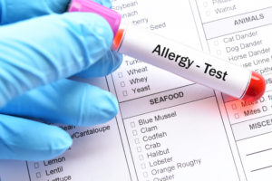 Common Allergies Tested for in an Allergy Test