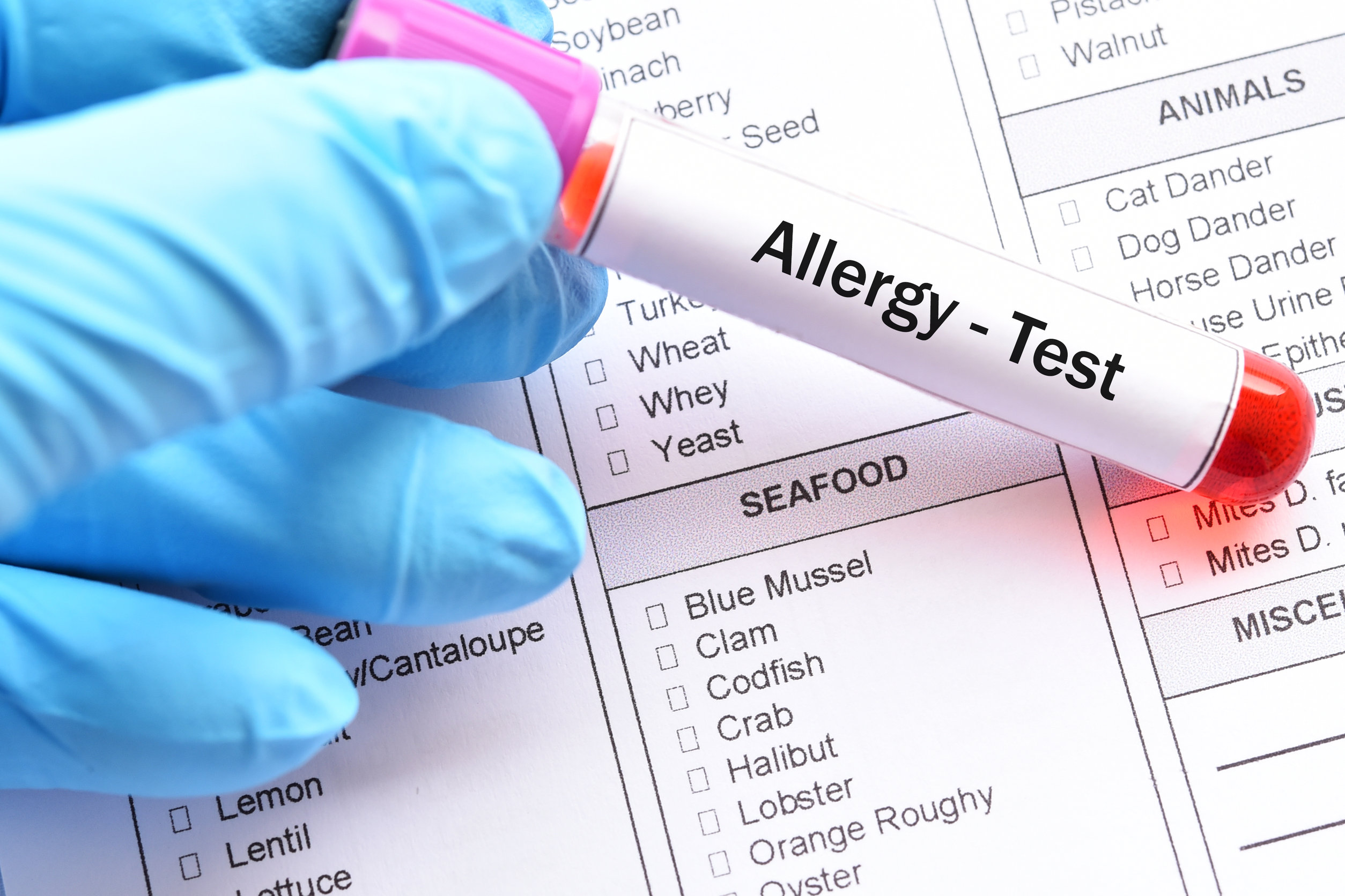 You are currently viewing Common Allergies Tested for in an Allergy Test