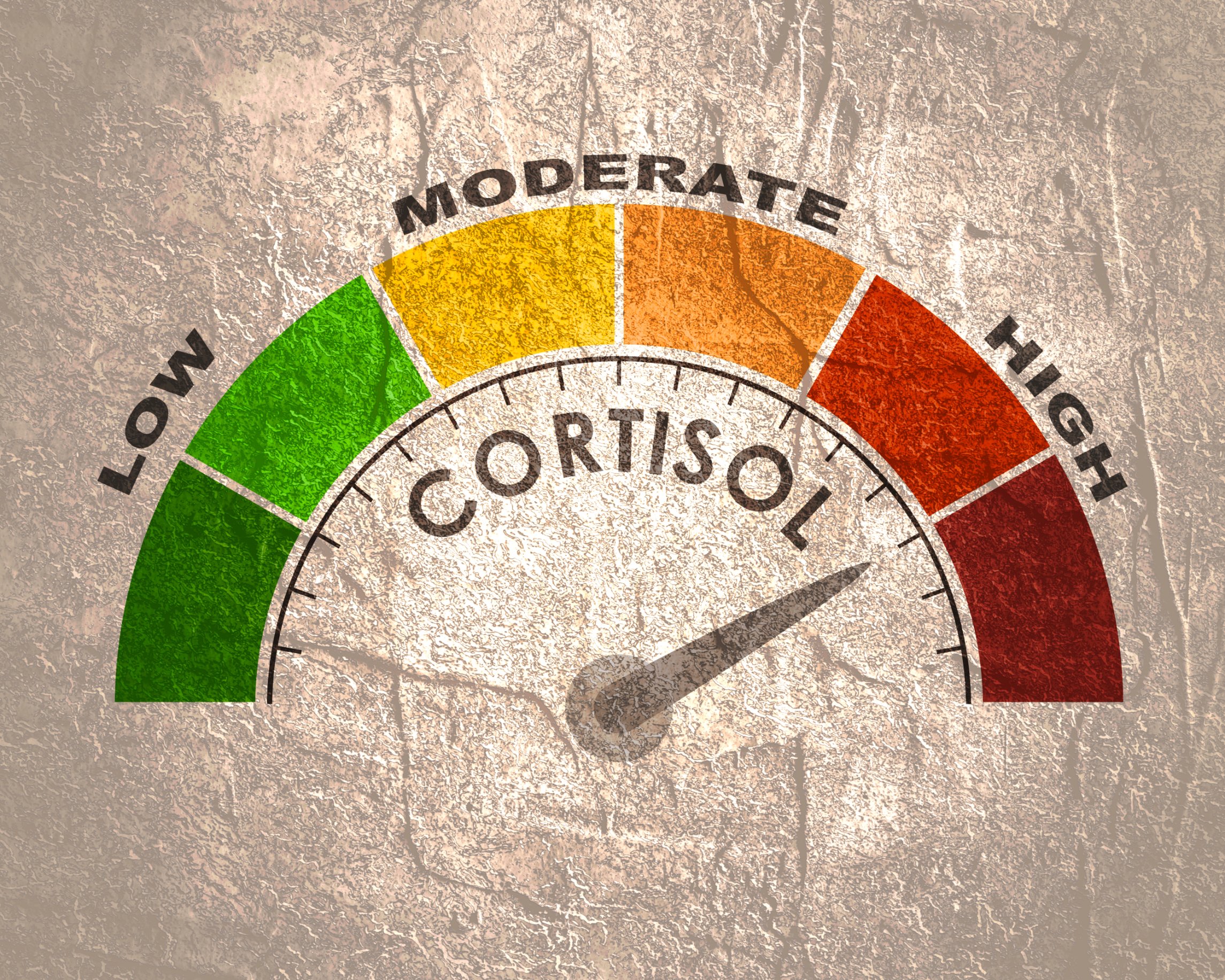 You are currently viewing High Cortisol and the Risk of Alzheimer’s Disease